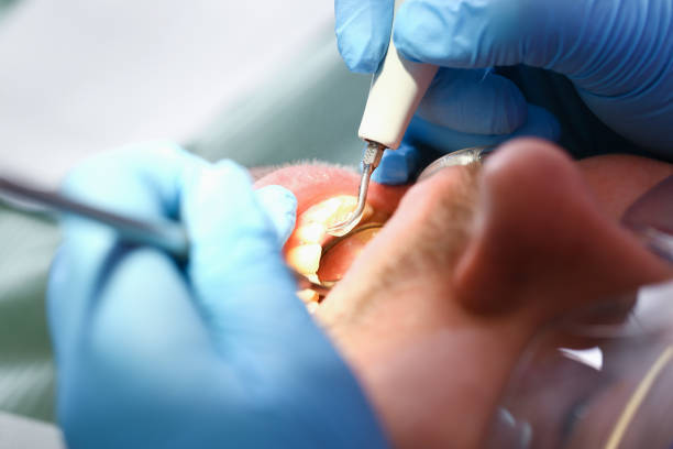 Best Emergency Broken Tooth Repair in The Hammocks, FL